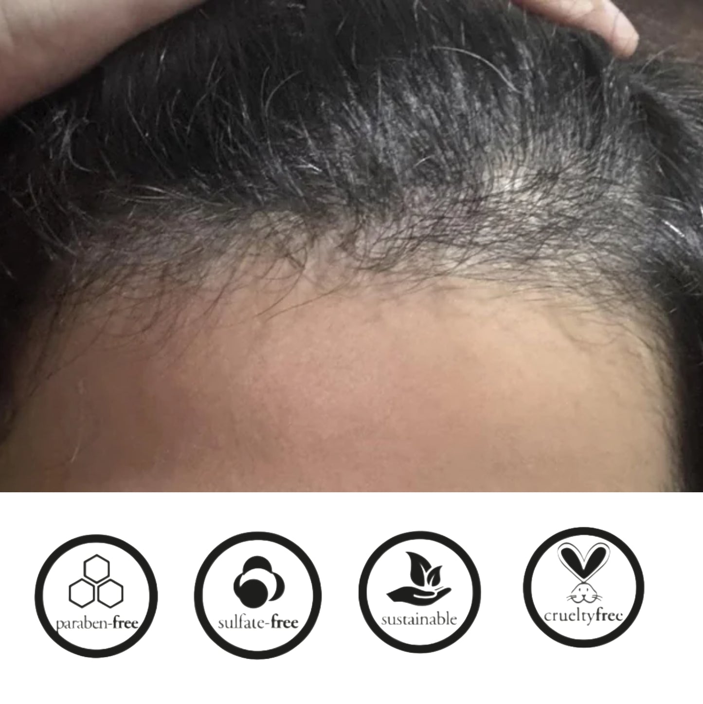 Mama's Roots Hibiscus Botanical Shampoo – Nourishing, Shine-Enhancing & Hair Revitalizing 300ML / 10.4 Onz